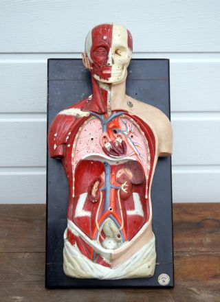 Antikes Somso Anatomie Modell Um 1900 - Marcus Sommer,  Sonneberg (3902) Bild
