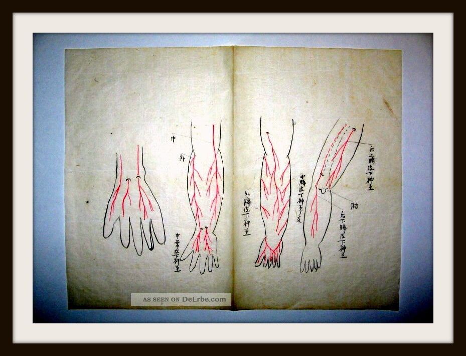Traditionelle Japan.  Medizin - Handschrift,  Seikotsu - Jutsu,  Handkoloriert,  Um 1700 Antiquitäten & Kunst Bild